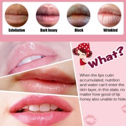 Lip gel mask - anti-wrinkle - moisturiser - collagen patches - 5 - 7 - 10 pieces