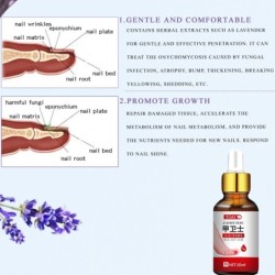 TratamientoGel para eliminar hongos en las uñas de los pies - suero - antiinfecciones / paroniquia / onicomicosis - 10ml