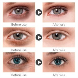 Brightening eye serum - Vitamin CSkin