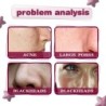 PielSuero facial - esencia de ácido de frutas - AHA - BHA - tratamiento del acné - blanqueamiento - 30ml
