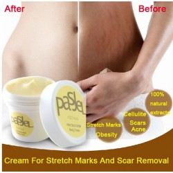 Stretch marks & scars removal creamMassage